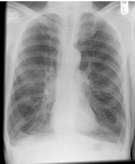 <p>whats the dx?</p>