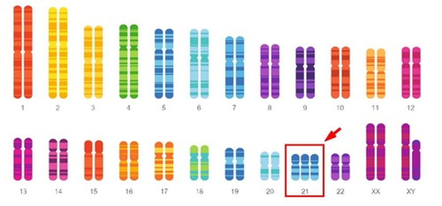 <p>(47, XX, +21) or (47, XY, +21).</p>