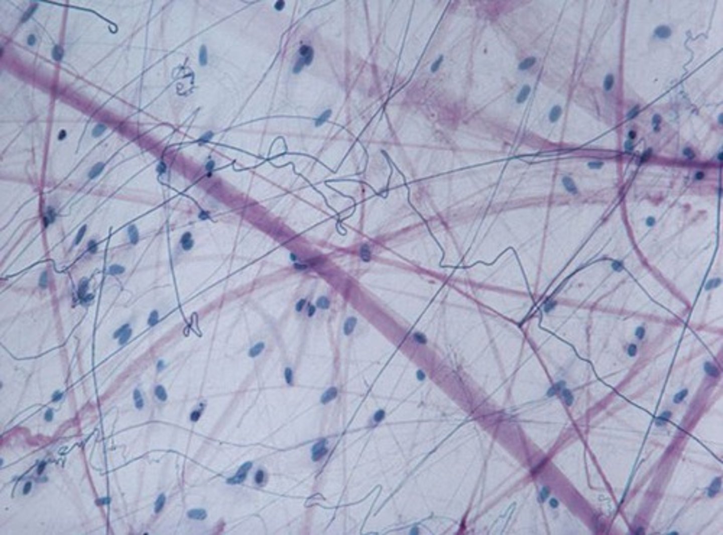<p>What tissue is this?</p>