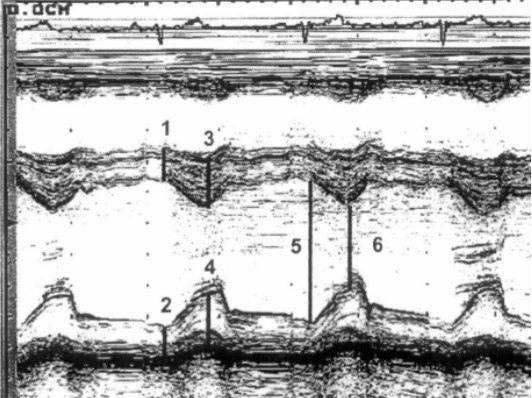 <p>Identify this image. </p>