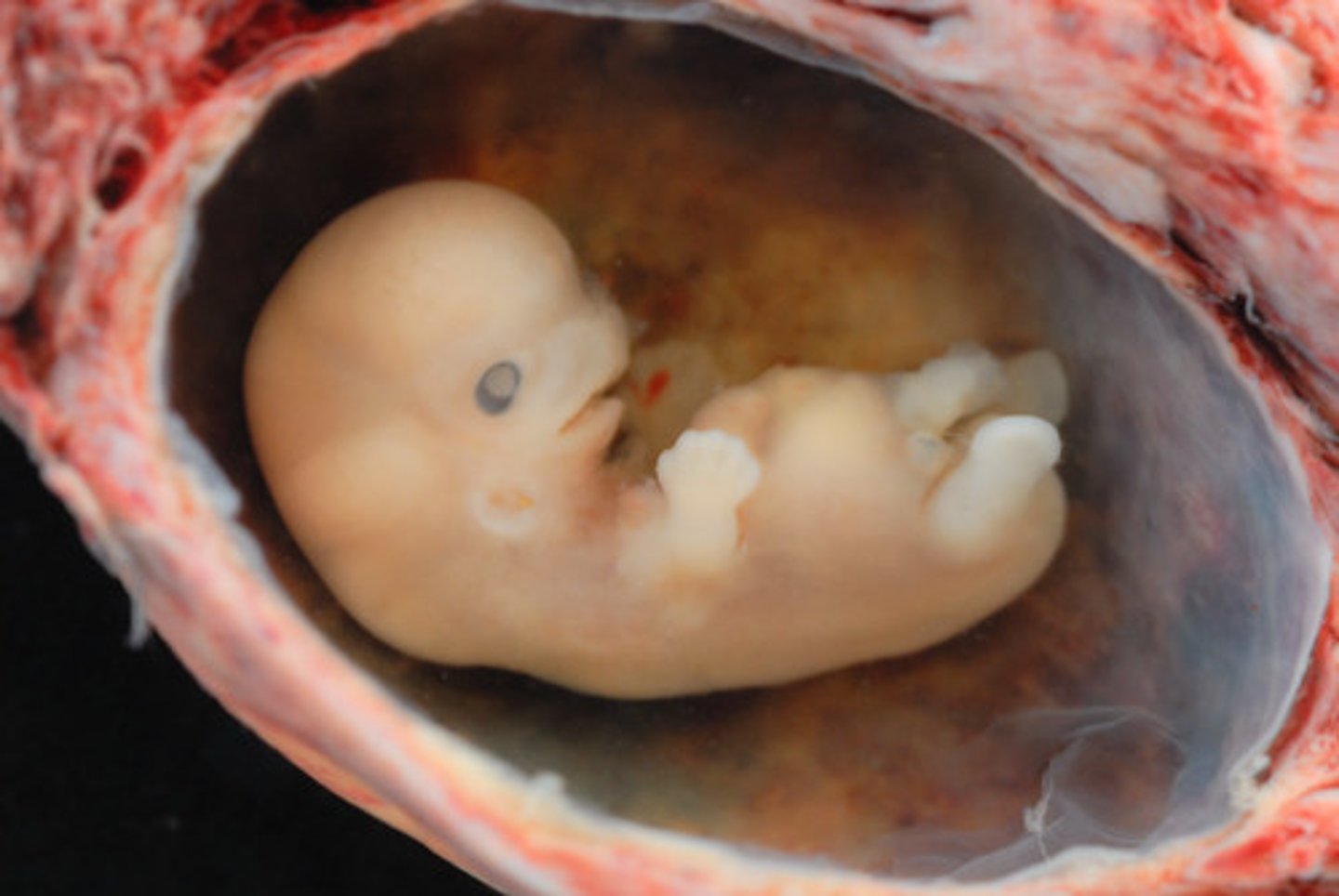 <p>the developing human organism from about 2 weeks after fertilization through the second month</p>