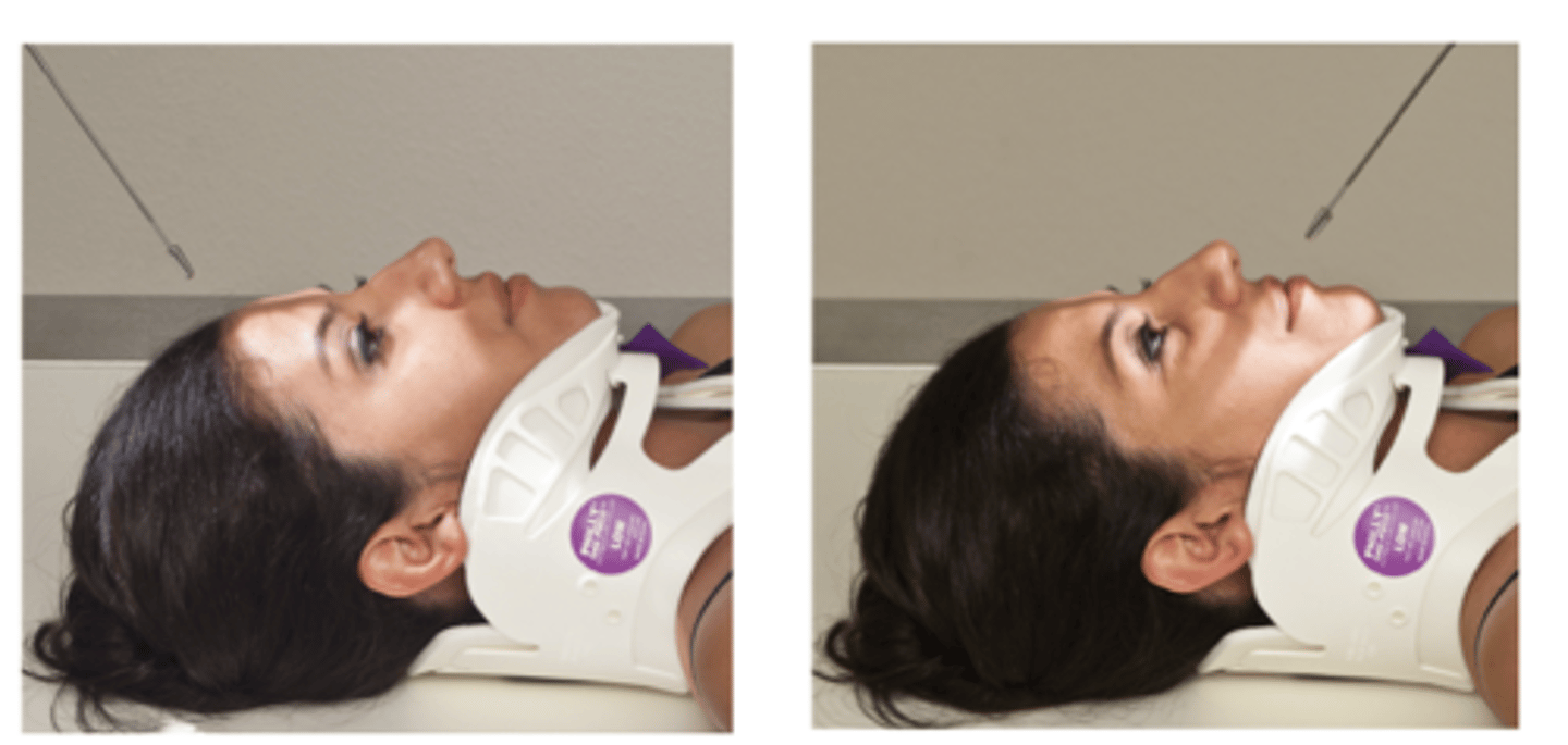<p>cephalad = toward the head</p><p>caudad = away from the head</p>