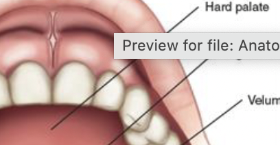 <p>hard roof of the mouth</p>