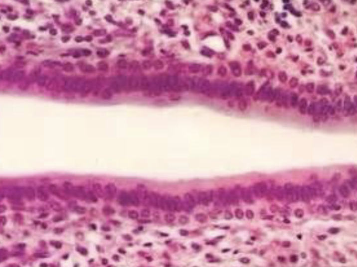<p>what type of tissue is this </p>