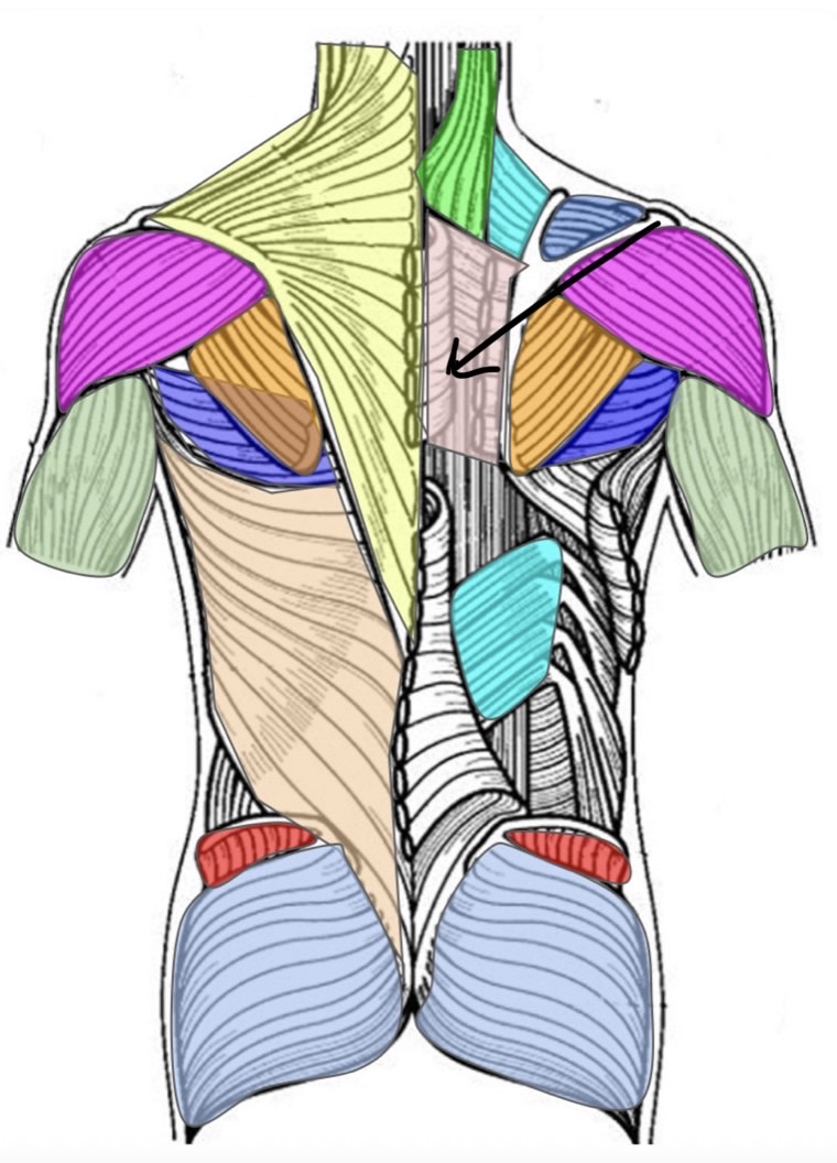 term image