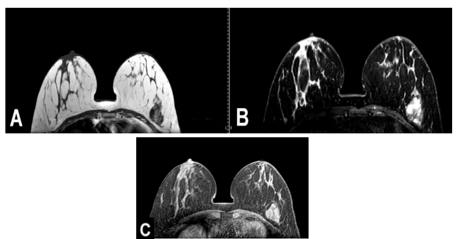 <p>What can be seen in this MRI image?</p>