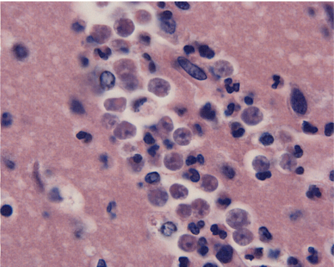 <ul><li><p>identify</p></li><li><p>m.o.t</p></li><li><p>infective stage</p></li><li><p>host</p></li></ul><p></p>