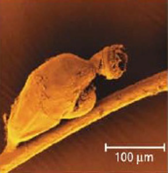 <p>Symbion pandora</p>