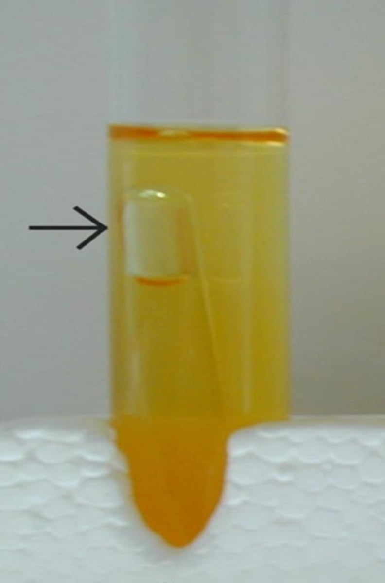 <p>What is the small tube in in the Denitrification test</p>