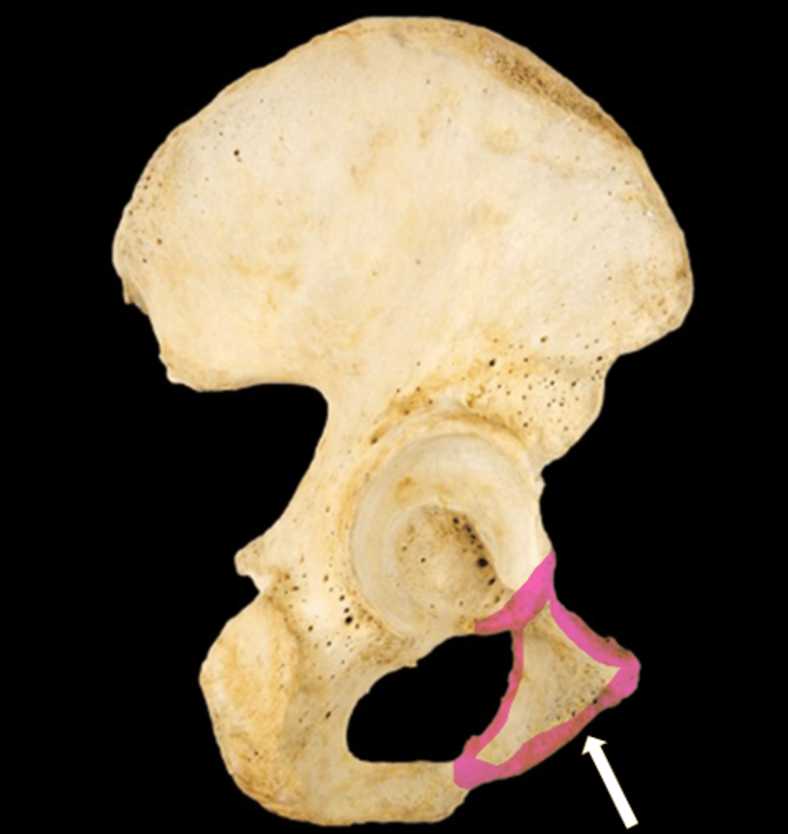 <p>name the bone</p>