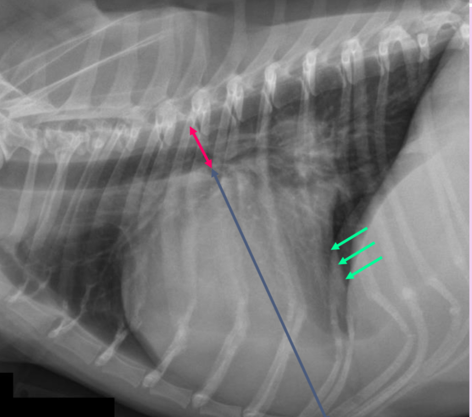 <p>-tall heart (>2/3 DV diameter)</p><p>-dorsal displacement of trachea (almost parallel to spine)</p><p>-straightening of cd. border of heart</p>