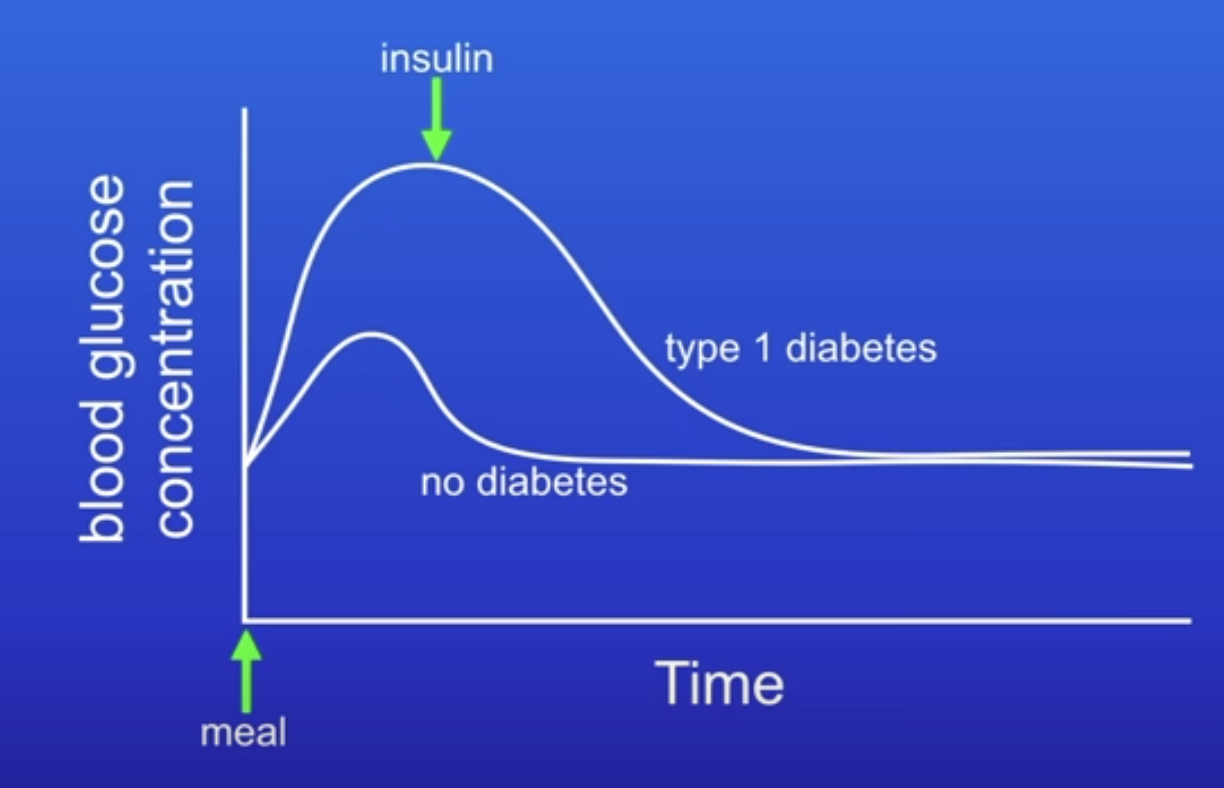 <p>How does the graph showing the blood glucose concentration of people with type 1 diabetes vs no diabetes show the effects of type 1 diabetes?</p>