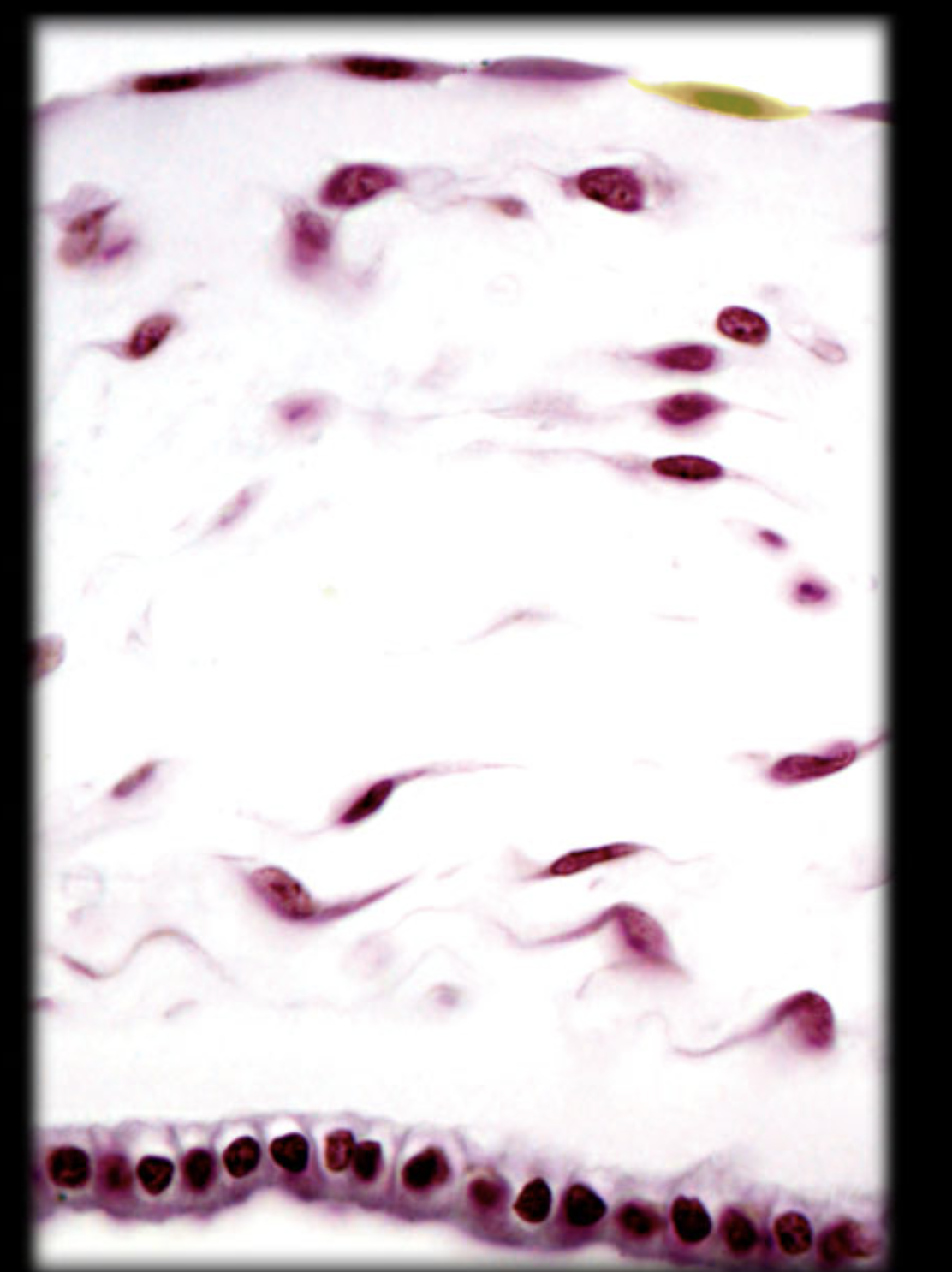 <p>Squamous cell</p>