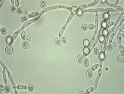 <p><span>How is Candida Albicans diagnosed</span></p>