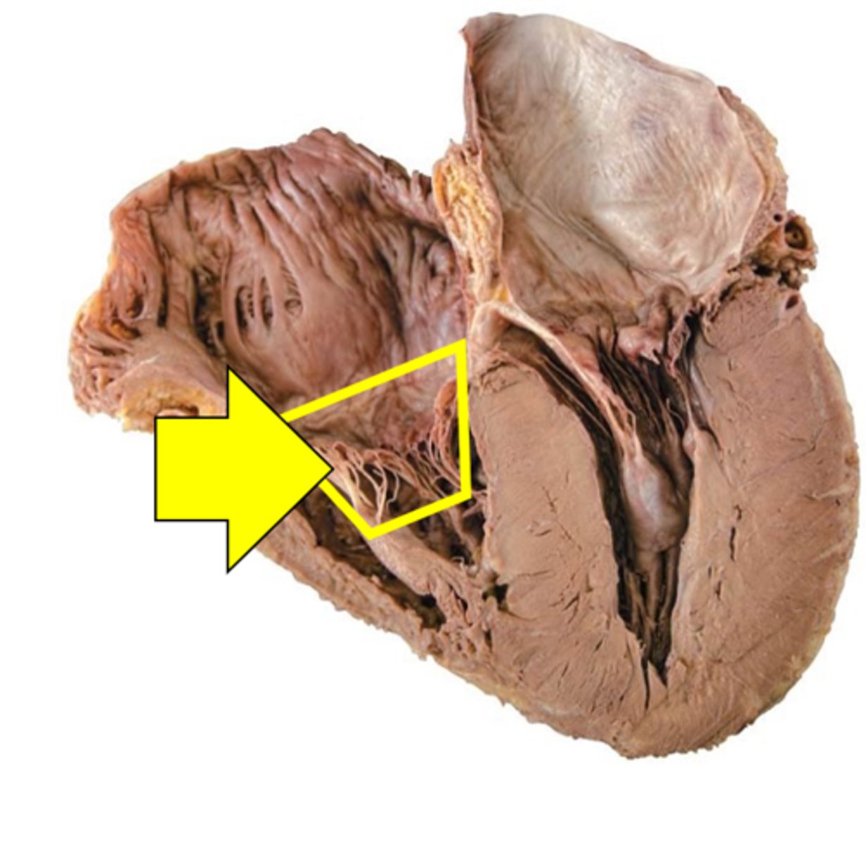<p>Name the structure.</p>