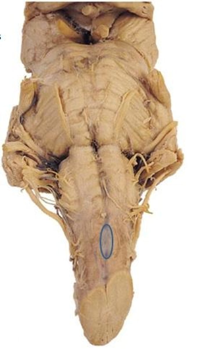 <p>location at which corticospinal tract fibers cross the midline and the sulcus disappears briefly</p>