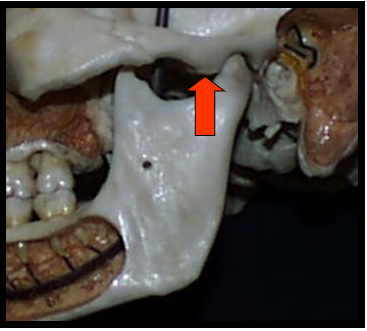 <ul><li><p><span>Rounded projection of the temporal bone located anterior to the glenoid fossa.</span></p></li></ul><p></p>