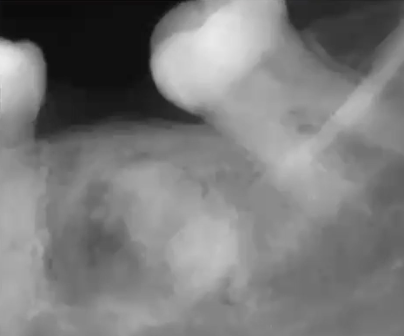 <p>What is this PA showing?</p>