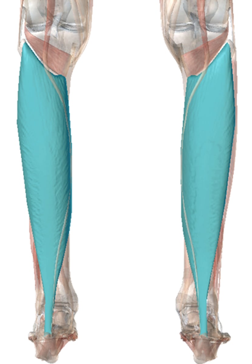 <p>name the muscle</p>
