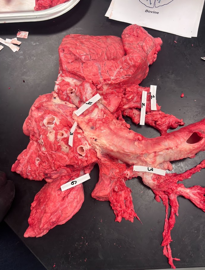 <p>What does number 6 represent on the lung?</p>