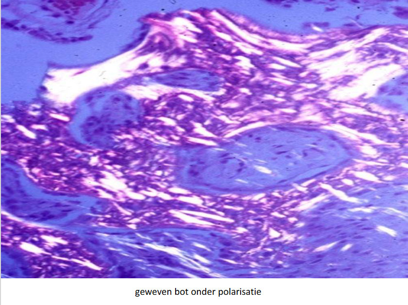 <ul><li><p>1e type van botorganisatie in embryologische ontwikkeling, bij botnieuwvorming &amp; botreparatieprocessen (bv. na fractuur)</p><p>= immatuur bot</p></li><li><p>geweven bot is in volwassenen tijdelijk (‘primair bot’) &amp; wordt in principe vervangen door secundair (lamellair) bot</p></li><li><p>gekenmerkt door at random organisatie van type I collageen (vezelig bot)</p></li><li><p>lager mineraalgehalte &amp; meer en grotere osteocyten dan in lamellair bot</p></li><li><p>geweven bot: snel gevormd maar is onregelmatig van structuur &amp; heeft geringere draagkracht (inferieur aan lamellair bot)</p></li></ul><p></p>