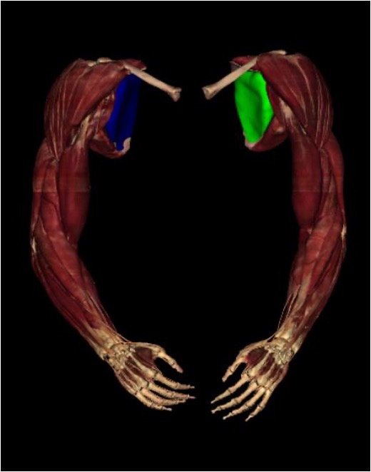 <p><strong>origin:</strong> subscapular fossa of scapula</p><p><strong>insertion: </strong>lesser tubercle of humerus</p><p><strong>innervation:</strong> upper and lower subscapular n (C5-C7)</p><p><strong>action:</strong> -medially rotates arm</p><p>-adduct arm</p><p>-help hold humeral head in glenoid cavity</p>