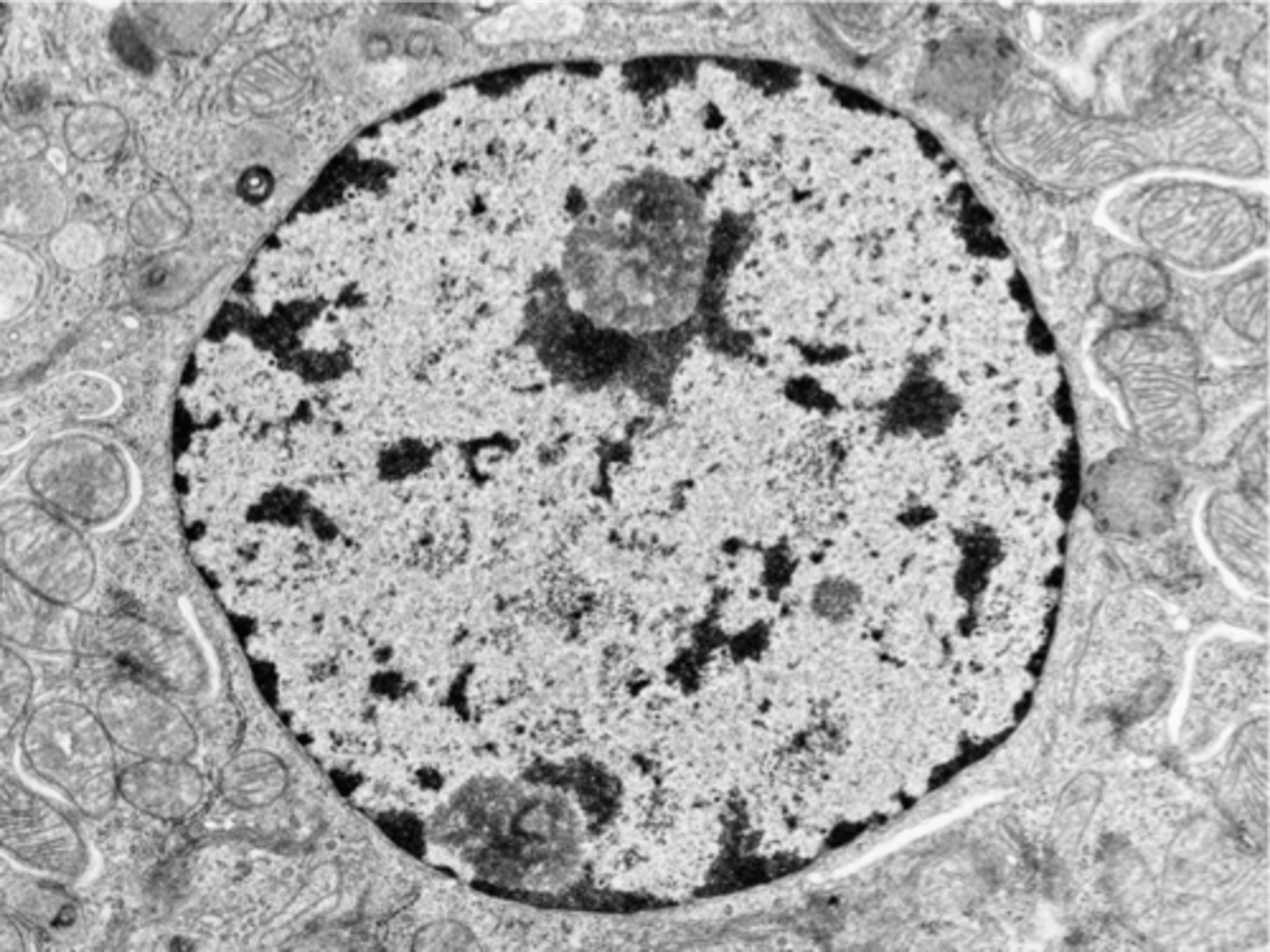 <p>Transcriptionally active and appears as dispersed fine granules with slightly basophilic clumps. </p>
