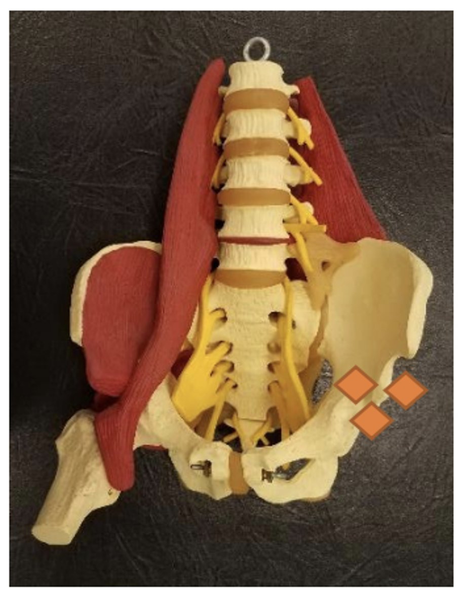 <p>lateral to AIIS</p>