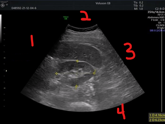 <p>label each number and determine the imaging plane</p>