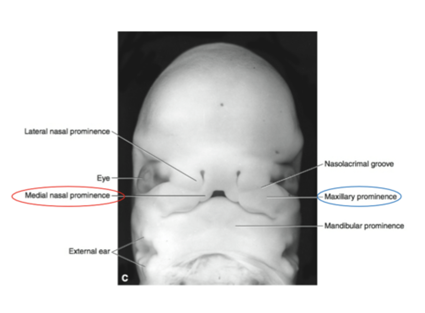 <p>The maxillary process merge with the nasal prominences to form? </p>