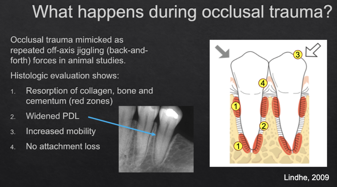 <ol><li><p>resorption of collagen, bone, cementum</p></li><li><p>widened PDL</p></li><li><p>increased mobility </p></li><li><p>no attachment loss</p></li></ol><p></p>