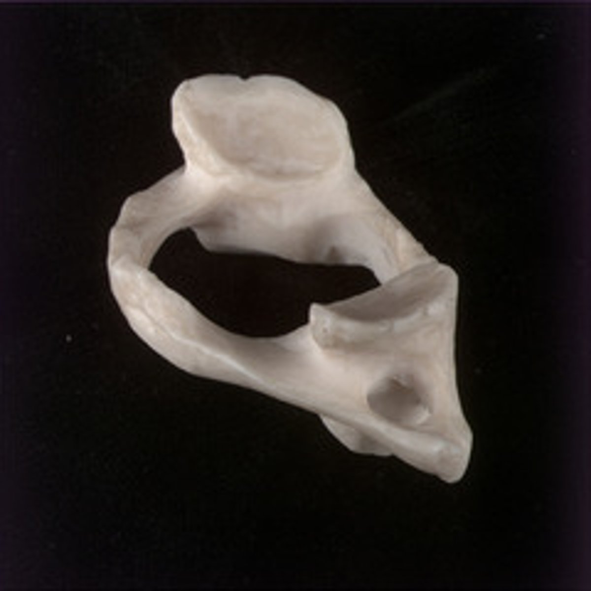 <p>Name the bone.</p>