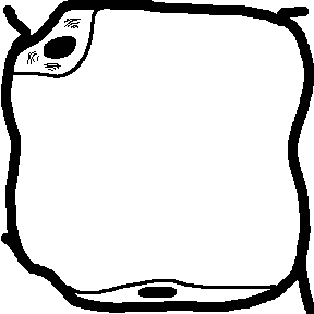 <p>Ga try ra man nig capture og bacteria ani na slide, there is a related slide on phagocytosis </p>