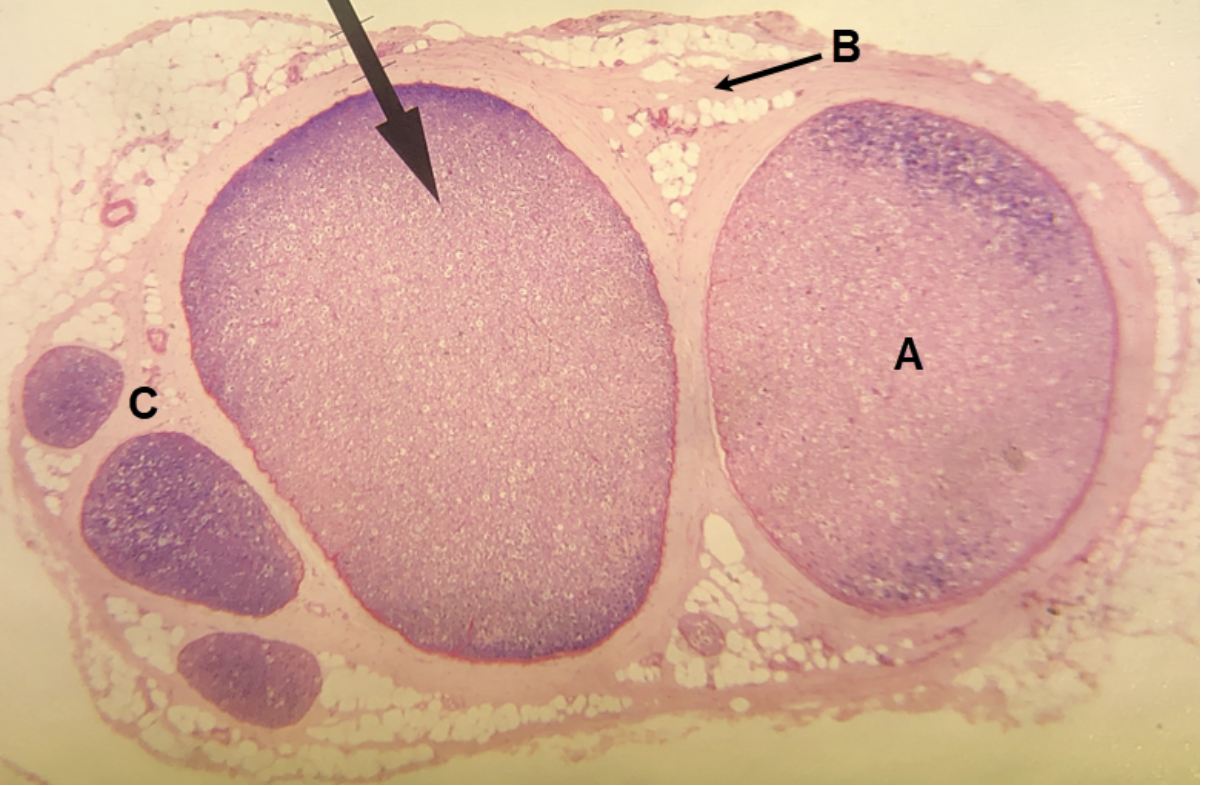 <p><span><span>In the image above, identify structures A-C.</span></span></p>