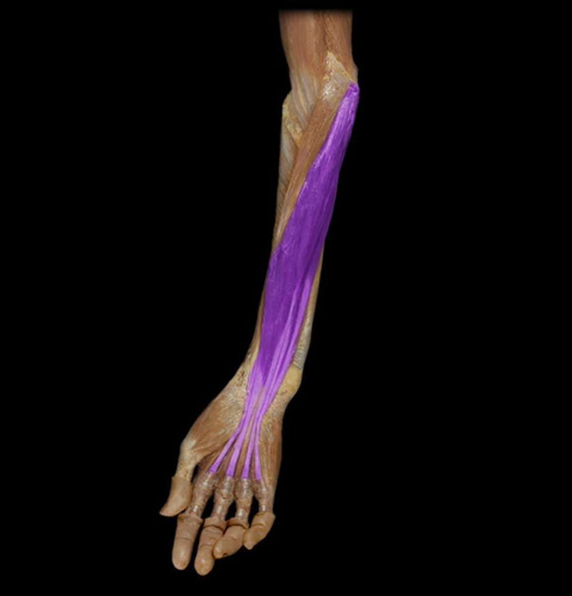 <p>Identify what the highlighted muscle</p>