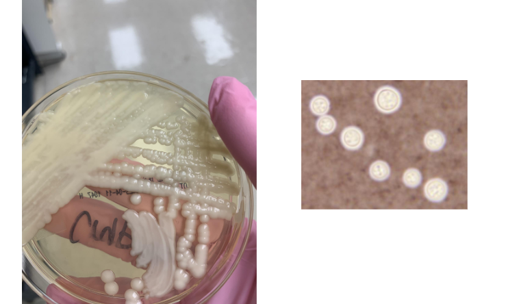 <p>you saw yeast in your gram stain from your BAP so you put it onto an SAB plate and saw this, what next step would you take</p>
