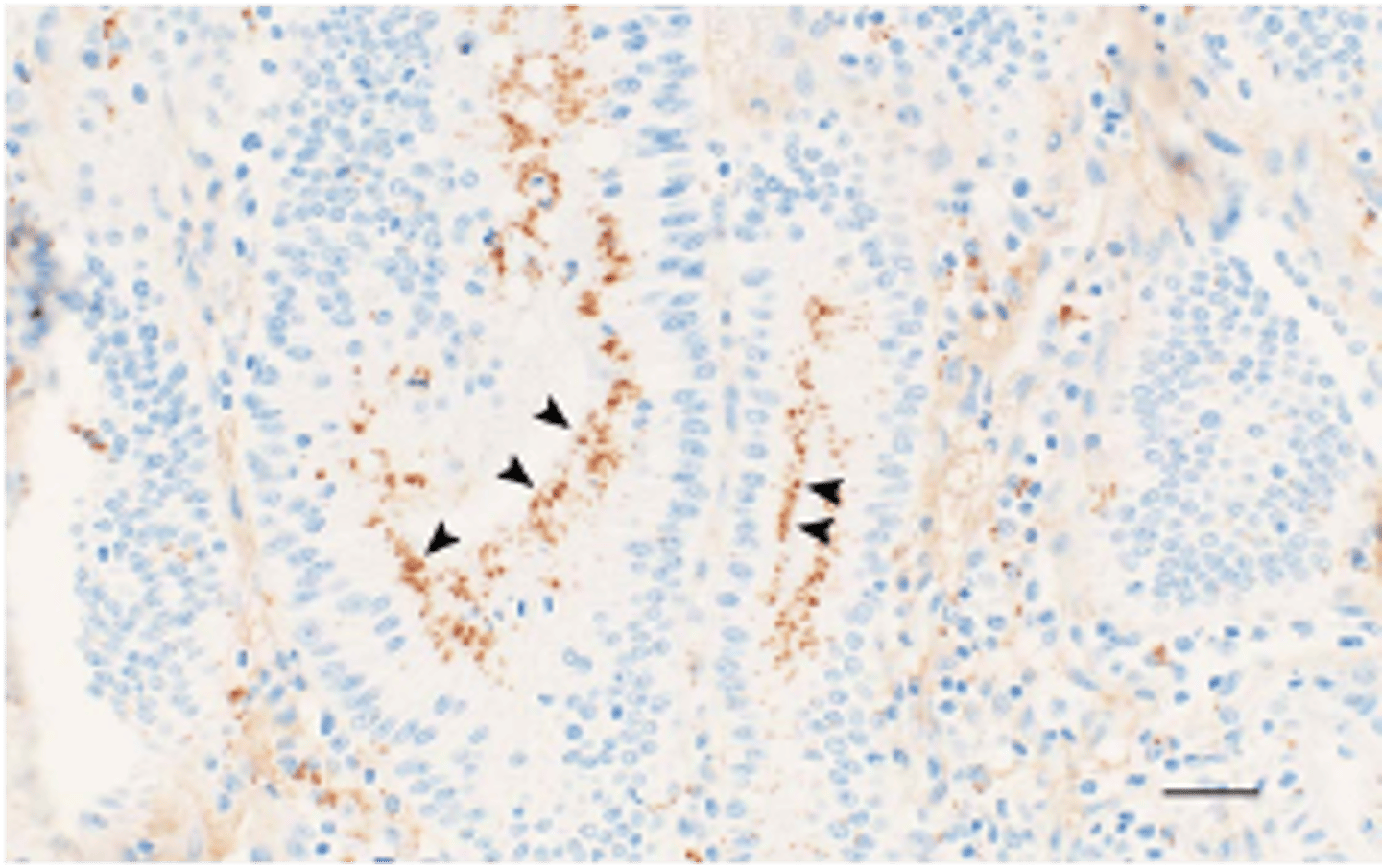 <p>what is revealed in this tissue sample from the GIT</p>