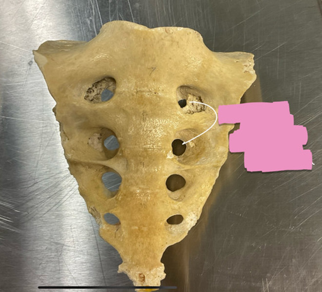 <p>What is the region in pink?</p>