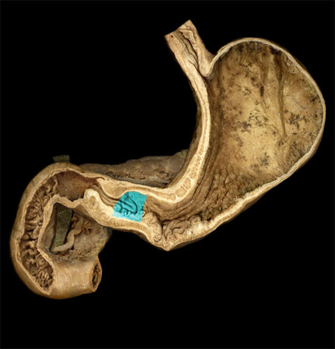 <p>what is highlighted in this image?</p>