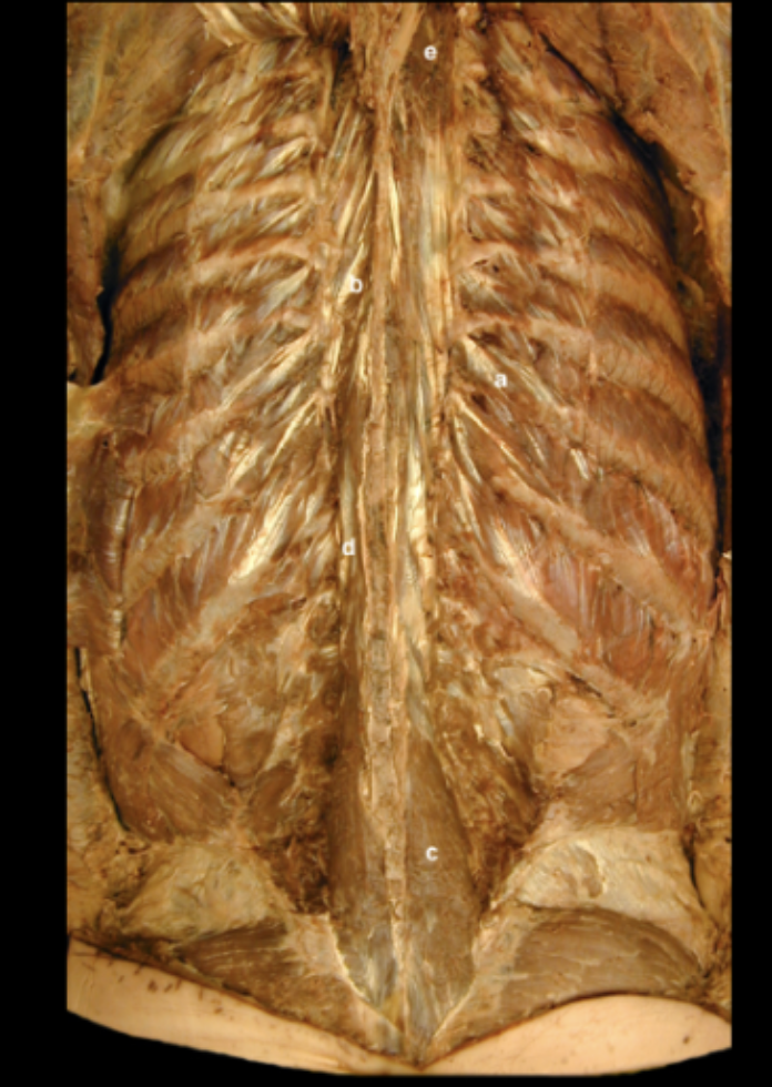 <p>Intrinsic Muscles of the Back </p>