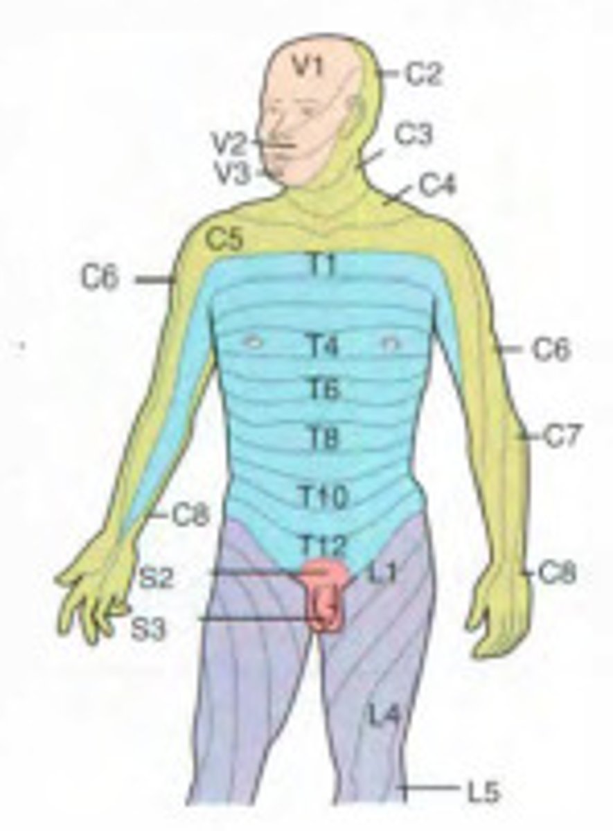 <p>Area of skin supplied by a single spinal nerve, except C1</p><p>Referred pain: EX: pain starts in T10, actually appendicitis</p>