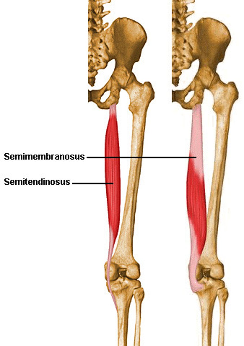<p>A: flexion of leg; extension of thigh</p><p>O: ischial tuberosity</p><p>I: medial condyle (tibia)</p>