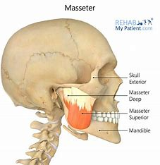 <p>origin: zygomatic bone</p><p>insertion: mandible</p><p>action: jaw closer, elevates mandible</p><p></p>