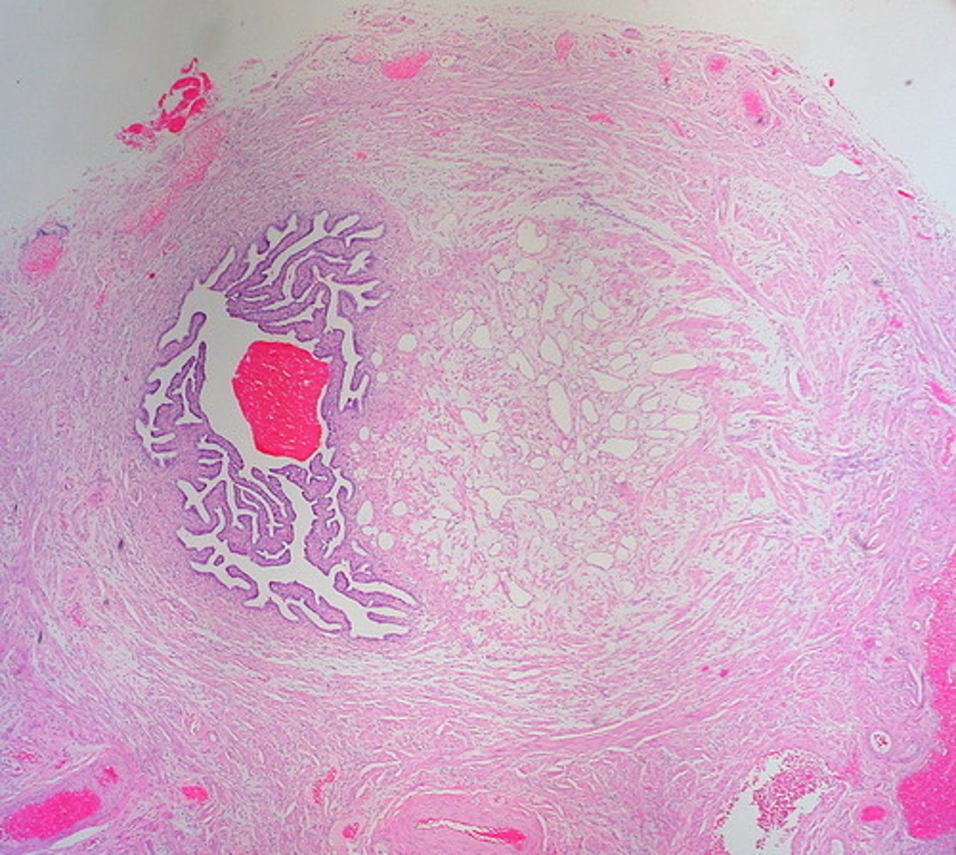 <p>(adj.) gentle, kind; forgiving, understanding; having a favorable or beneficial effect; not malignant.</p><p>synonyms: benevolent, salutary, salubrious, harmless</p><p>antonyms: malevolent, deleterious</p>