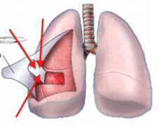 <p>A membrane around the lungs and inside the chest cavity.</p>