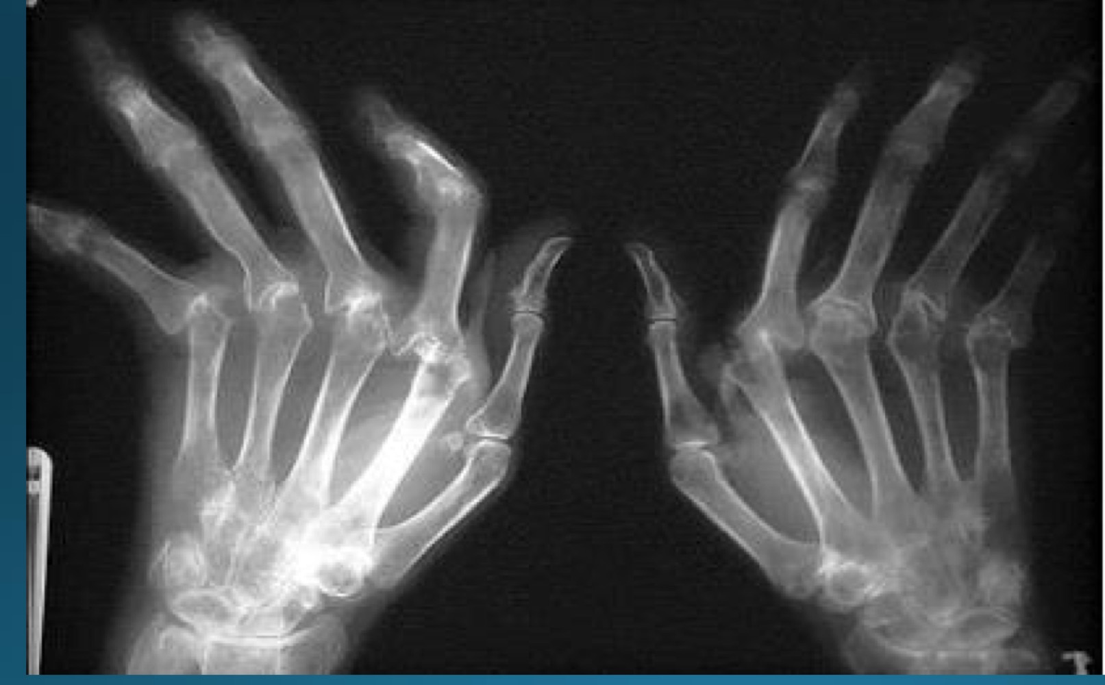 <p>what is the diagnosis </p>