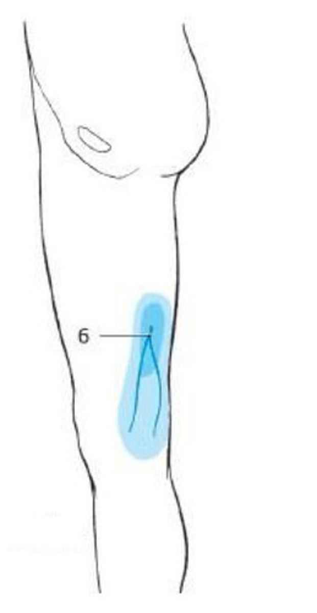 <p>What nerve supplies the blue in this picture?</p>