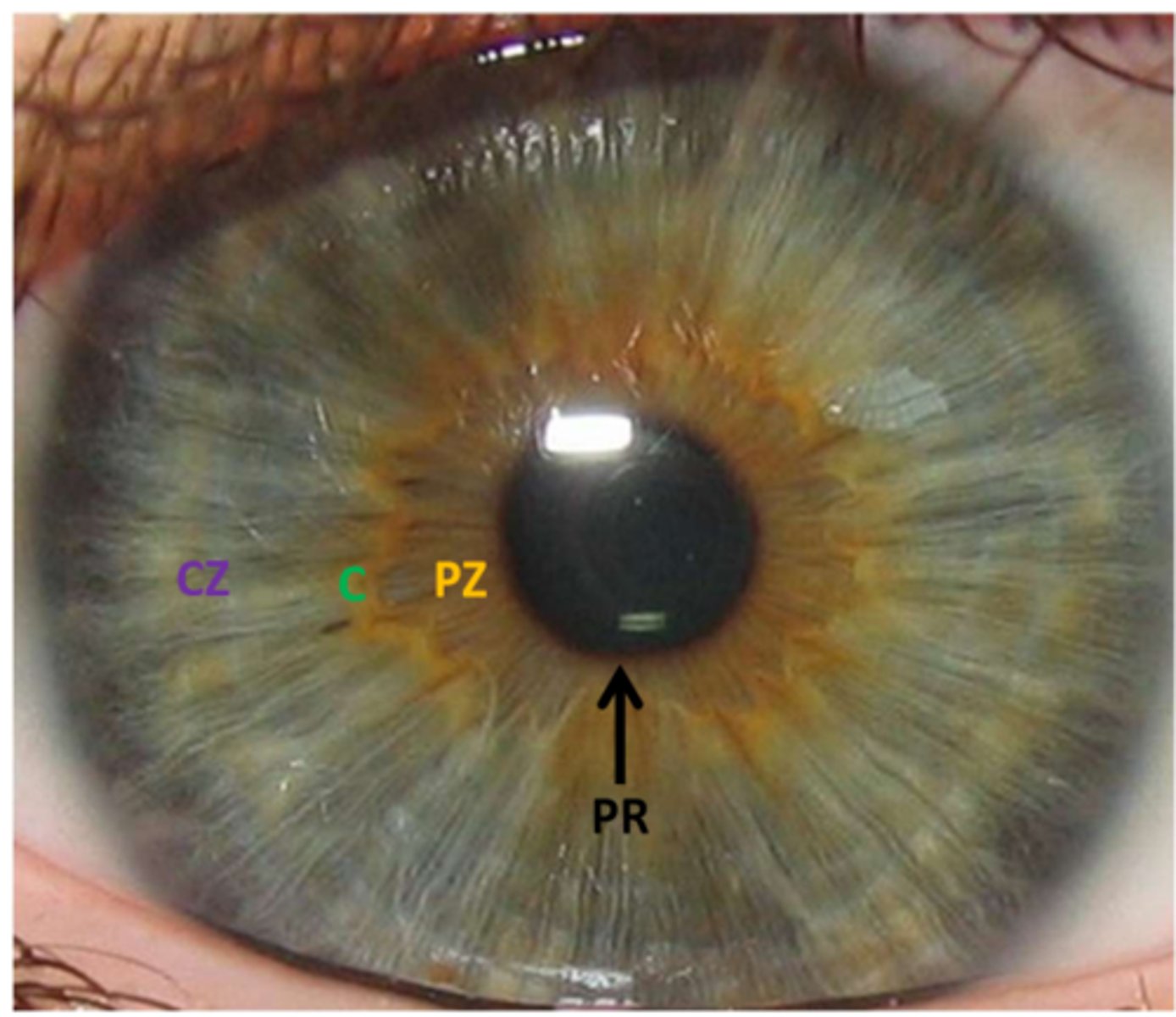 <p>Thickest iris region</p><p>-Remnant of embryonic pupillary membrane</p><p>-Divides iris into: Pupillary Zone (PZ) → collarette to pupil Ciliary Zone (CZ) → collarette to iris root</p>
