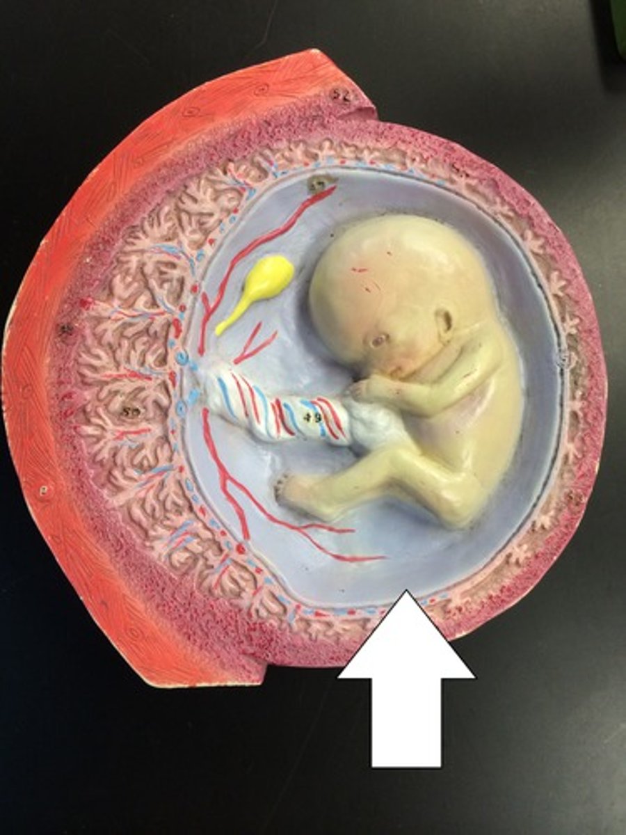 <p><strong>Fluid filled sac</strong>, which protects the embryo from<strong> trauma and temperature fluctuations allows freedom and movement</strong>, and <strong>prevents limbs from sticking to the body</strong></p>