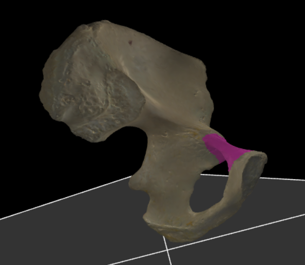 <p>De bovenste beenbalk van het os pubis die deel uitmaakt van de omtrek van het foramen obturatum.</p>
